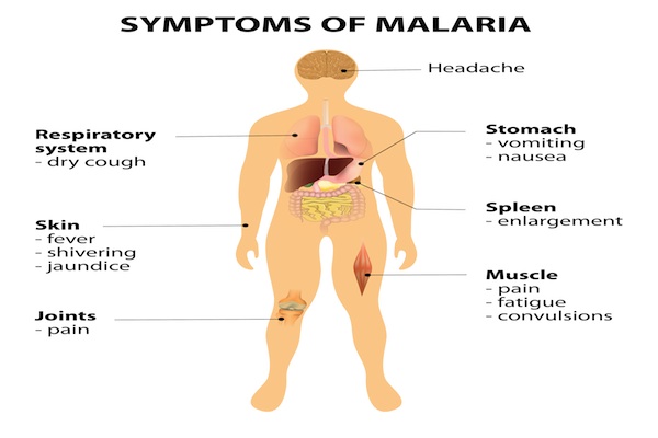 diagram of symptoms caused by the zika virus